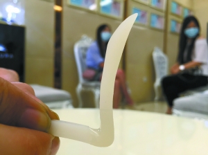 失敗的隆鼻手術中植入的假體被醫生取了出來。 記者全杰 攝